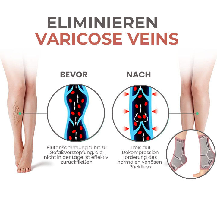 Oveallgo™ Selbstwärmende Tech Anti Ödeme Kompressionsstrümpfe