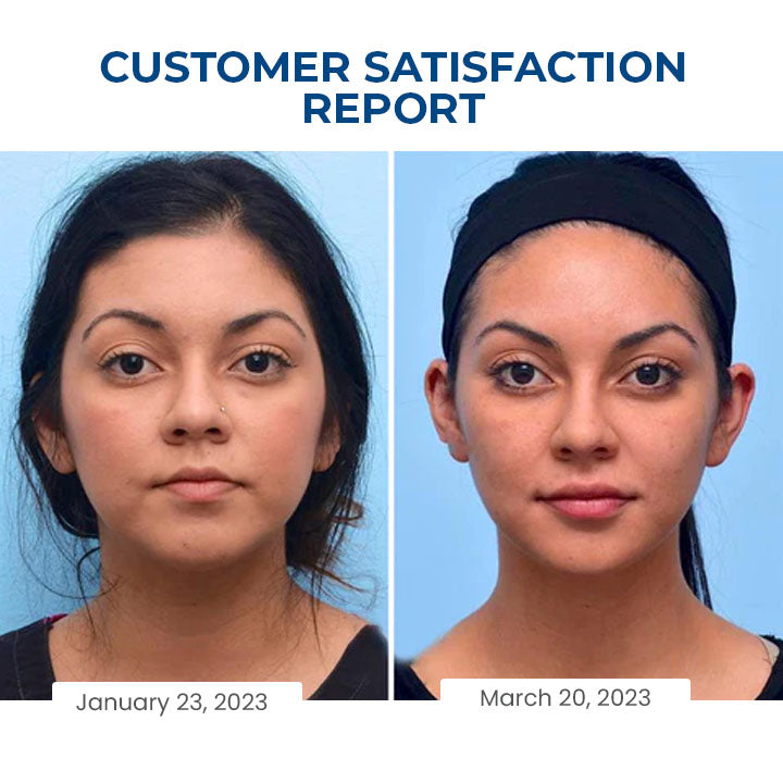 Fivfivgo™ SleepBeauty Face Sculptor
