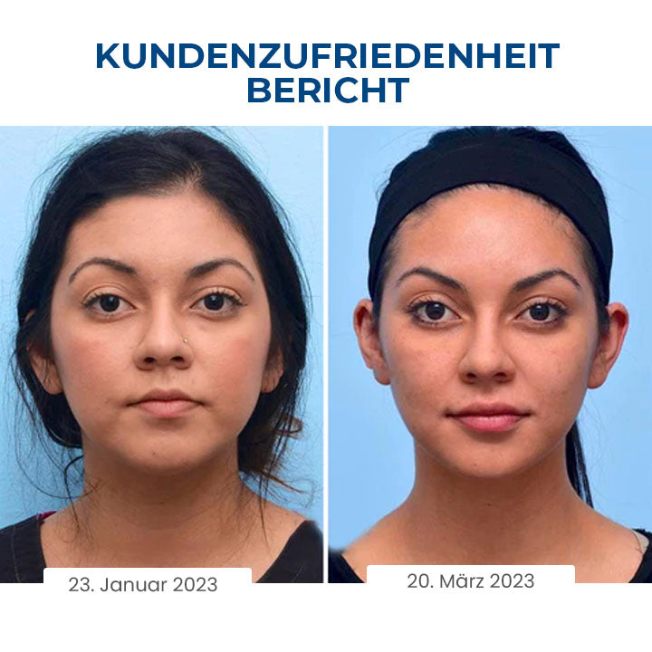 Fivfivgo™ SleepBeauty Gesichtsbildhauer