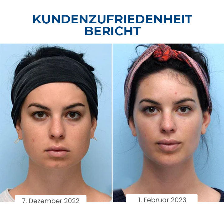 Fivfivgo™ SleepBeauty Gesichtsbildhauer
