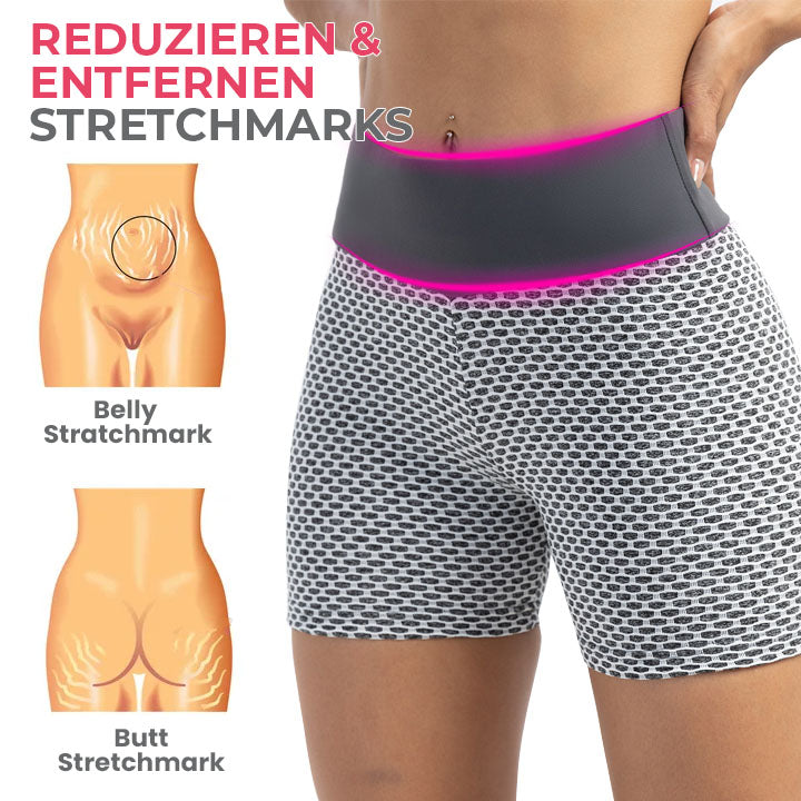 Oveallgo™ TraumPassform Ion Lifting und Formshorts