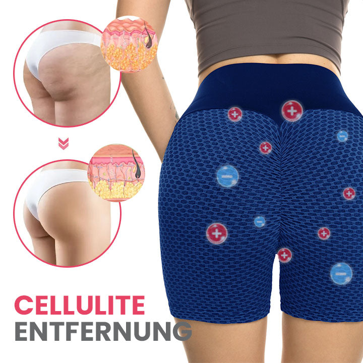 Oveallgo™ TraumPassform Ion Lifting und Formshorts