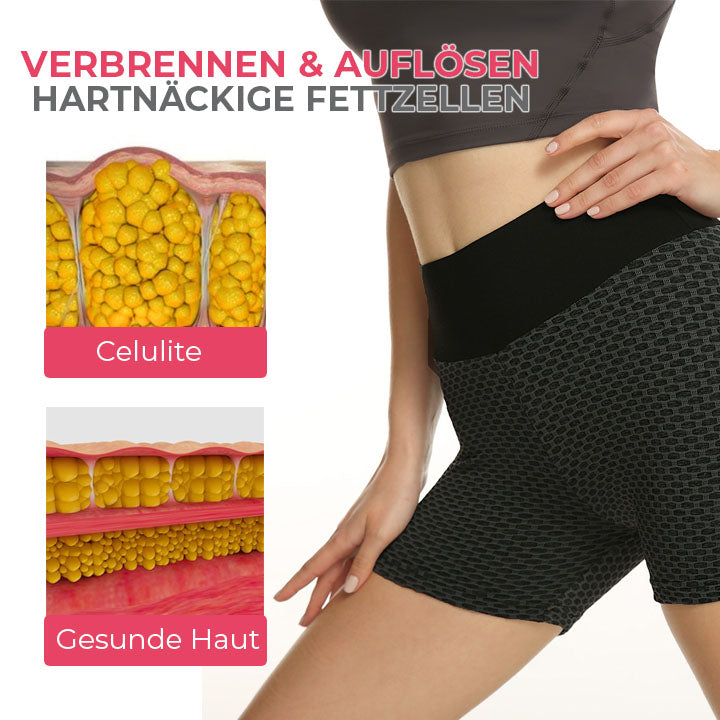 Oveallgo™ TraumPassform Ion Lifting und Formshorts