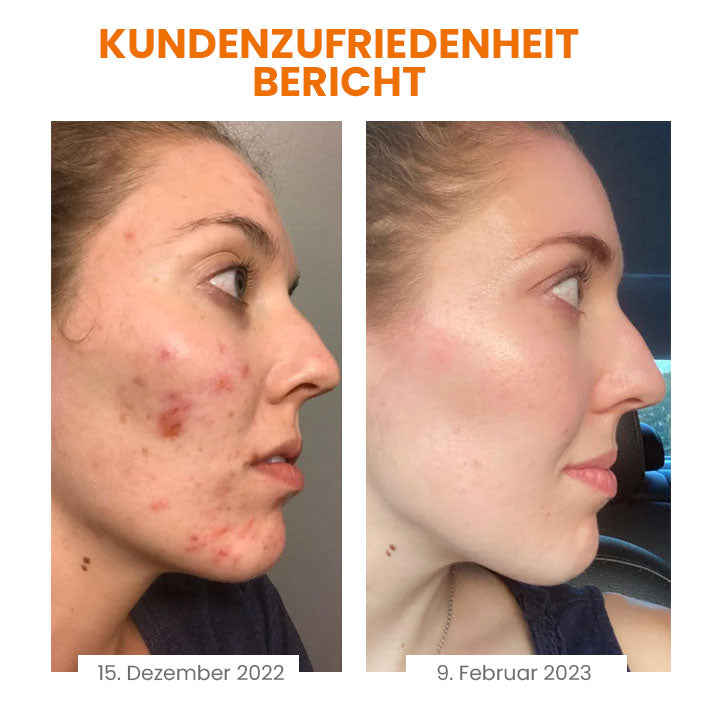 Fivfivgo™ Vitamin C aufhellende Seife