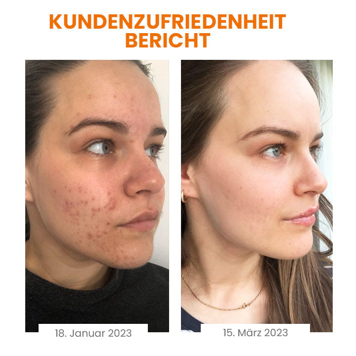 Fivfivgo™ Vitamin C aufhellende Seife