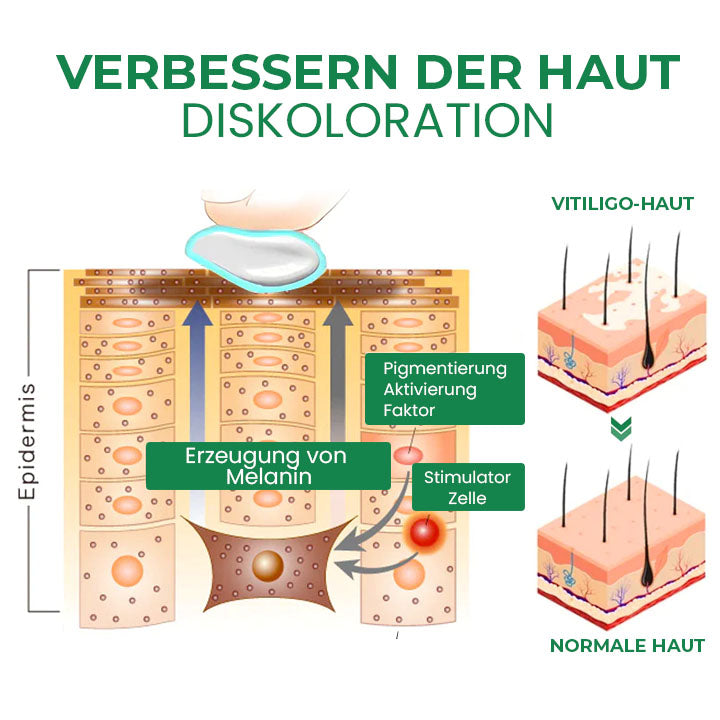 Fivfivgo™ VitiligoFix Revitalisierendes Elixier