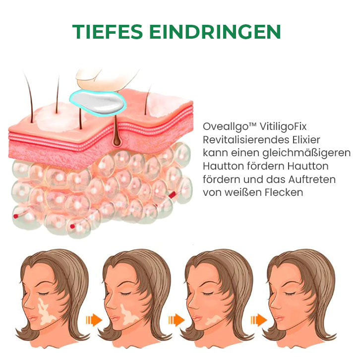 Fivfivgo™ VitiligoFix Revitalisierendes Elixier