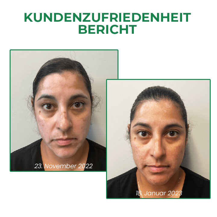 Fivfivgo™ VitiligoFix Revitalisierendes Elixier