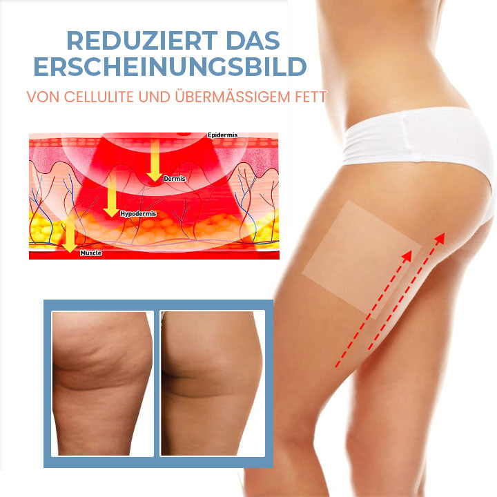 Fivfivgo™ Zelle Straffen Anti-Cellulite Kollagen-Straffungspflaster