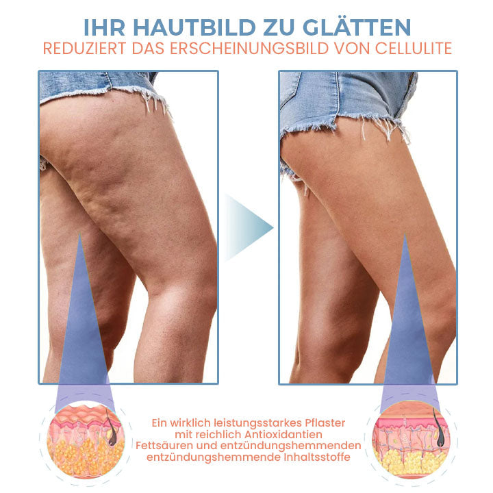 Fivfivgo™ Zelle Straffen Anti-Cellulite Kollagen-Straffungspflaster