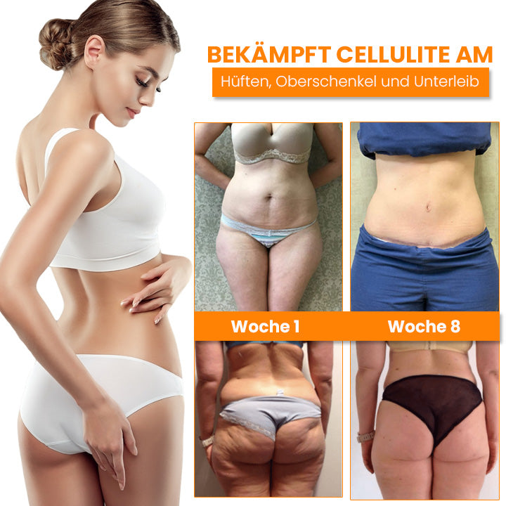 Fivfivgo™ BEAUTIFIC AntiCellulite Straffende Seife
