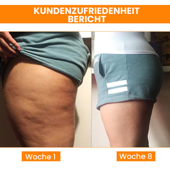 Fivfivgo™ BEAUTIFIC AntiCellulite Straffende Seife