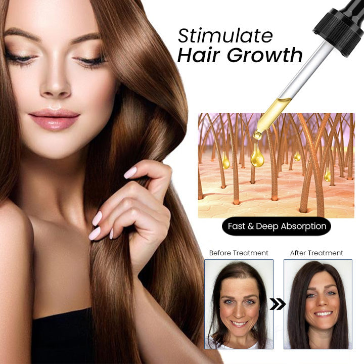 Sadoer Ginger Essence Hair Serum