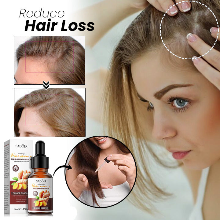 Sadoer Ginger Essence Hair Serum