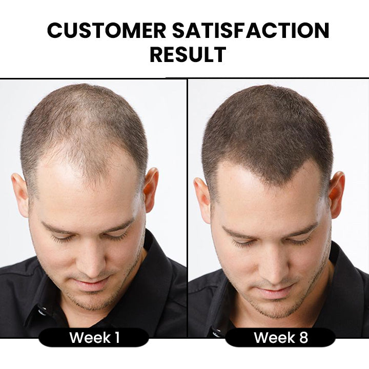 Sadoer Ginger Essence Hair Serum