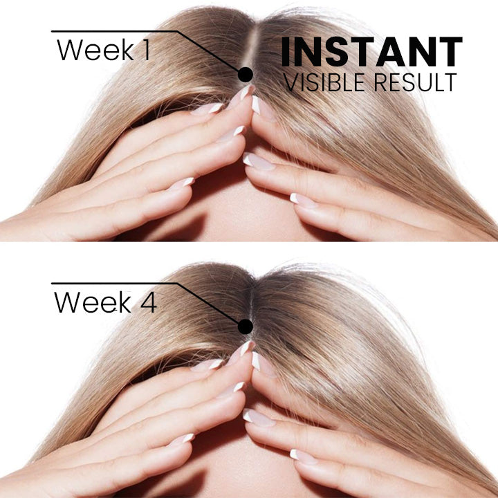 ShougaGRO Japanisches Haarwachstumsspray