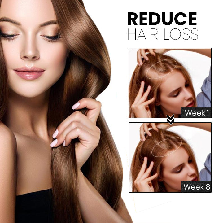 ShougaGRO Japanisches Haarwachstumsspray