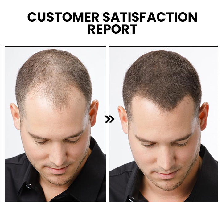 ShougaGRO Japanisches Haarwachstumsspray