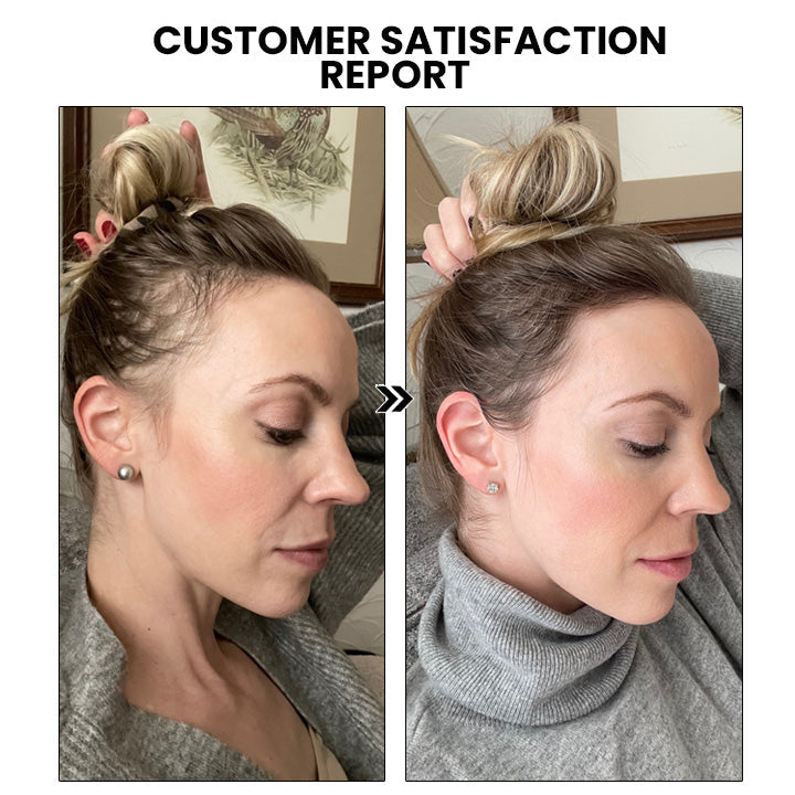 ShougaGRO Japanisches Haarwachstumsspray