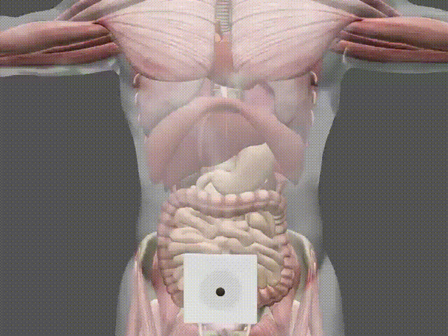 Fivfivgo™ Natural Herbal Pills Potent Constipation Belly Button Patch