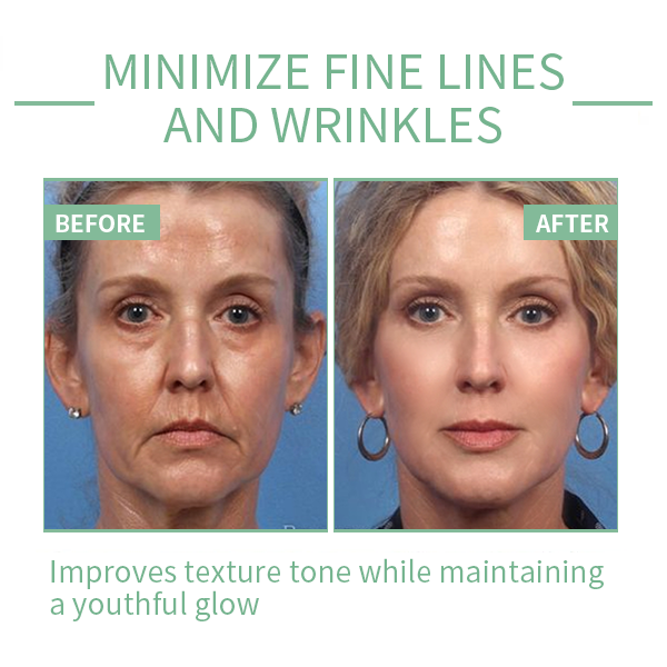 Fivfivgo™ 30 Days Advanced Collagen Boost Anti-Aging Botox Face Serum